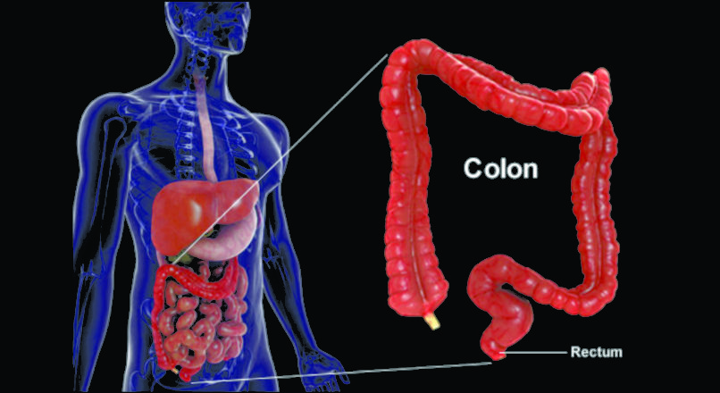 which colon cleanse is best
